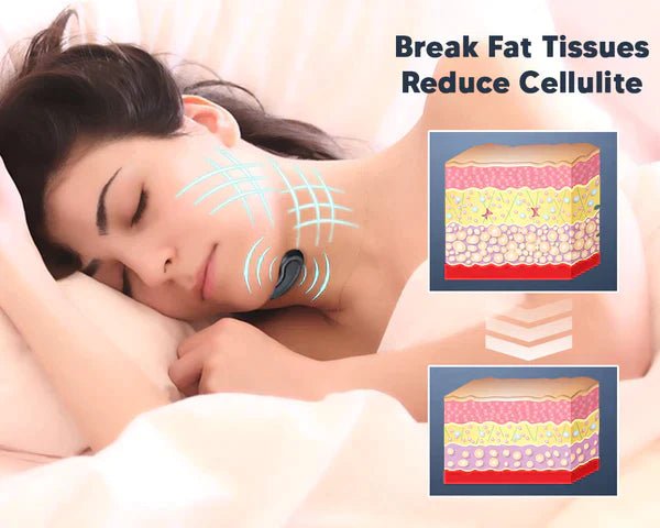 GFOUK™ EMSculpt Sleeping V-Face Beauty Device - beumoonshop