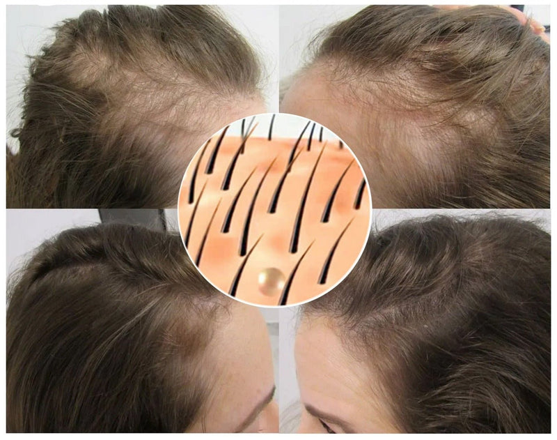 GINGER NOURISHING SPRAY - Hair Growth - beumoonshop