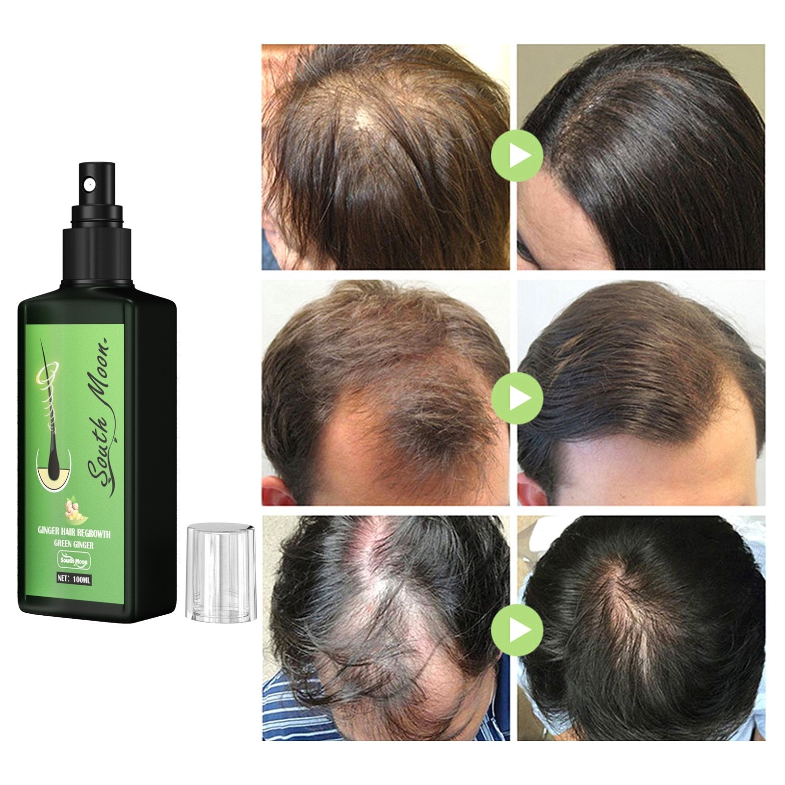 GINGER NOURISHING SPRAY - Hair Growth - beumoonshop