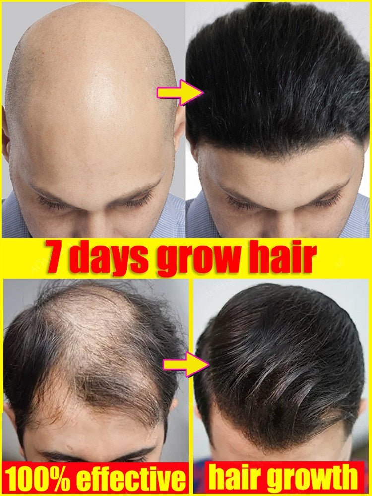 Hair Growth Oil - beumoonshop