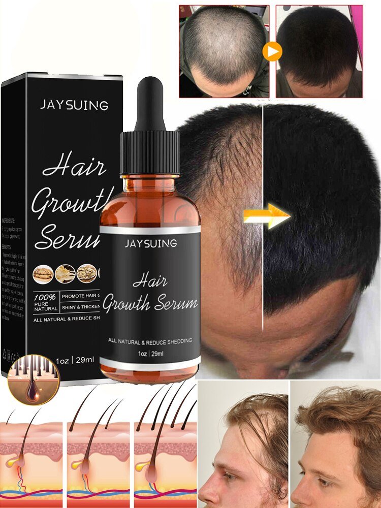 Hair Growth Oil - beumoonshop