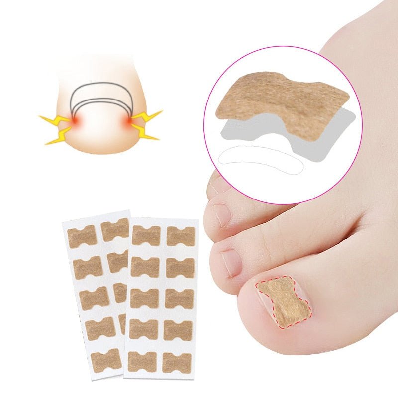 Painless Toenail Patch - ToenailExpress™ - beumoonshop