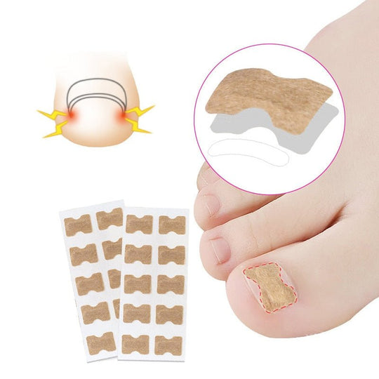 Painless Toenail Patch - ToenailExpress™ - beumoonshop