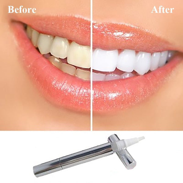 Perfect Teeth Whitening Pen - beumoonshop