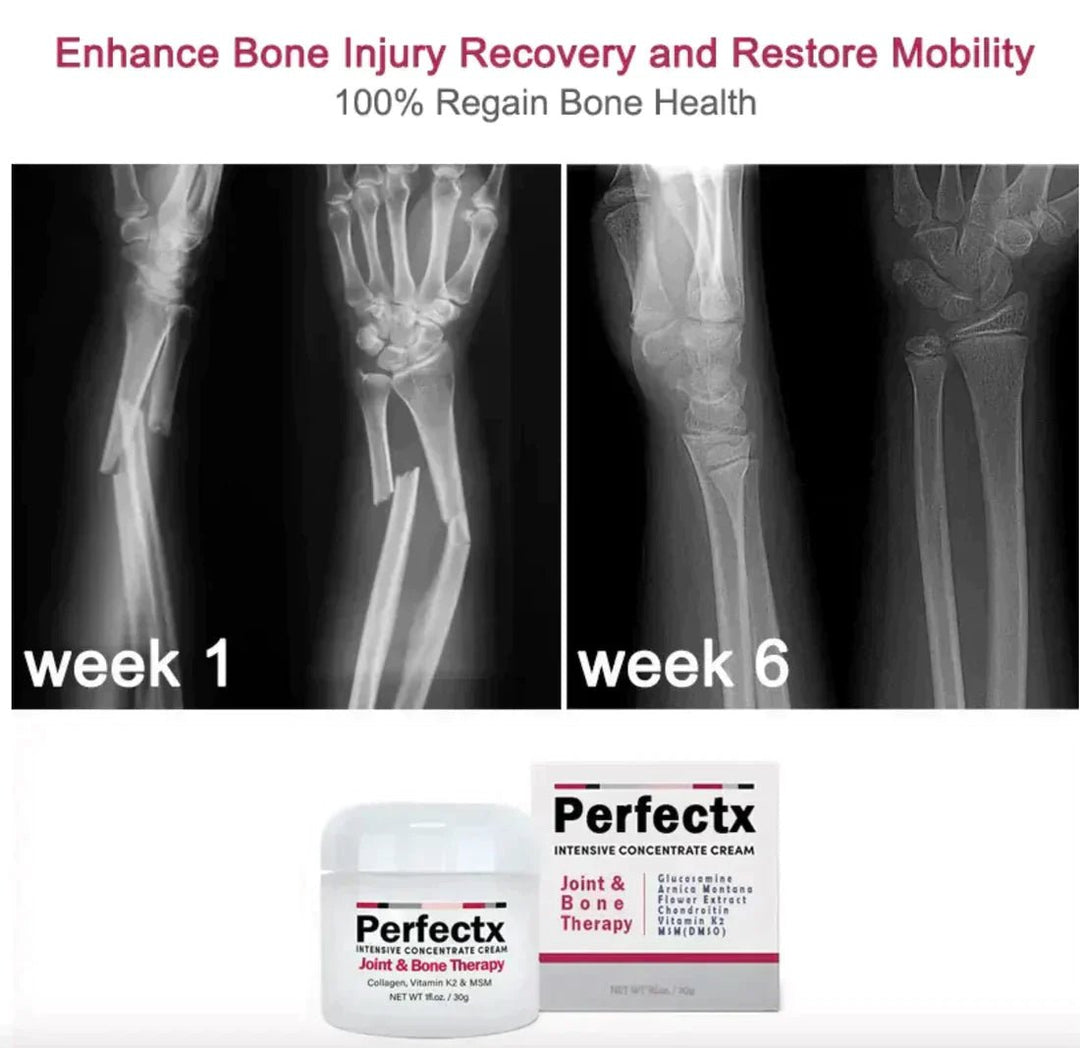 Perfectx Joint And Bone Therapy Cream - beumoonshop