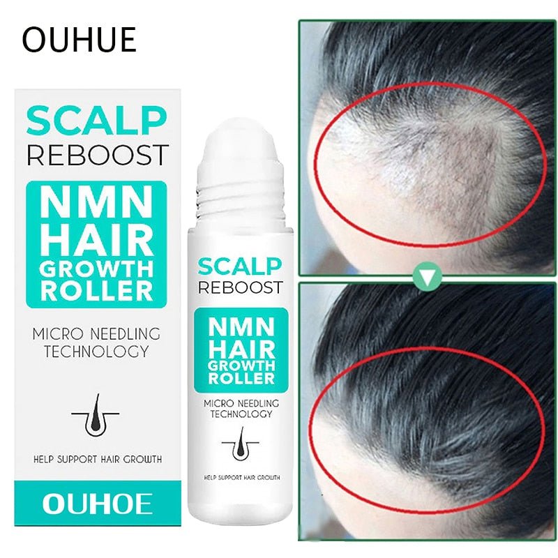 Rapid Hair Growth Serum Roller - beumoonshop