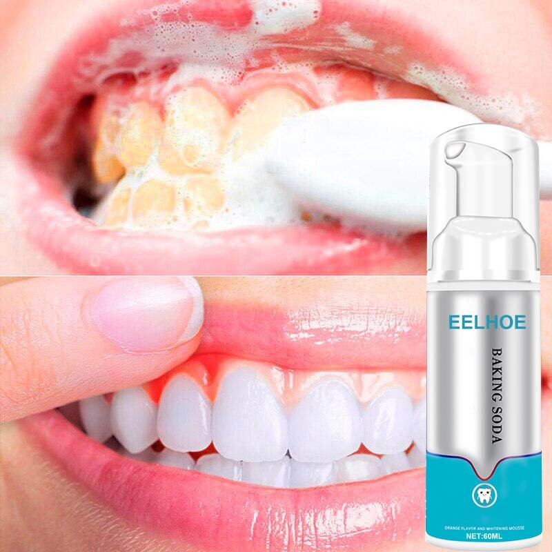 Teeth Whitening Mousse Toothpaste - beumoonshop
